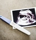 בדיקות אולטרסאונד בהיריון - כל מה שחשוב לדעת-תמונה
